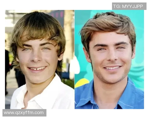 整容改变命运的足球球星揭秘他们的颜值背后故事